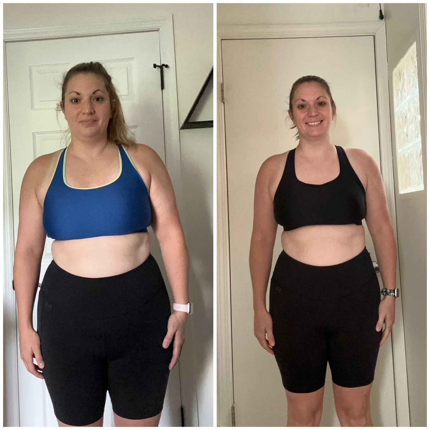 Michelle — sports bra before and after photos